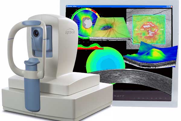 optical coherence tomography - crylink